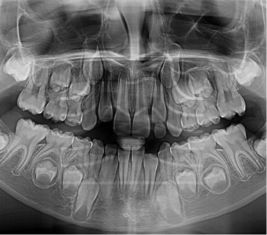 Studio Dentistico Schenardi - Ortopanoramica