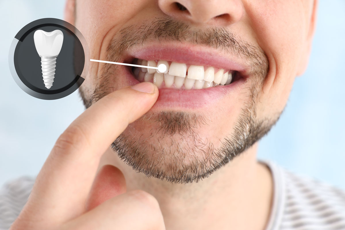 impianto dentale dolorante | Studio Dentistico Schenardi