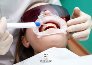 Come ottenere denti più bianchi in 3 modi diversi | Studio Dentistico Schenardi