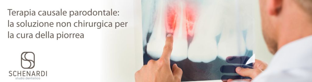terapia causale parodontale | Studio Dentistico Schenardi