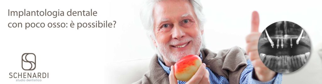 implantologia dentale con poco osso | Studio Dentistico Schenardi